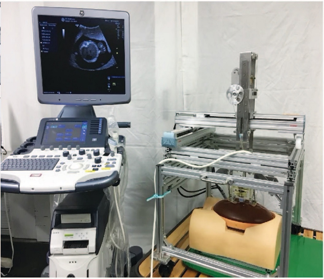 Ultrasound platform for prenatal diagnosis