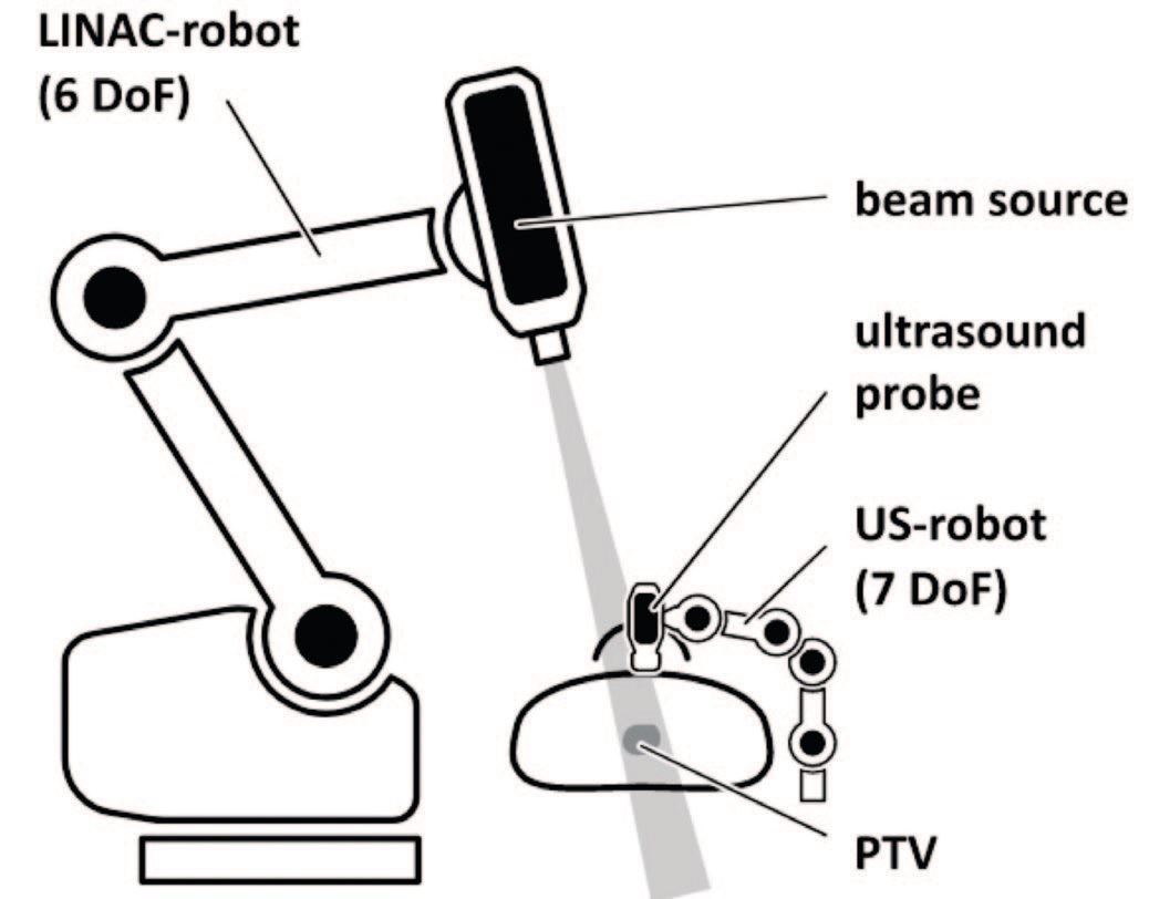 Robotic radiotherapy under ultrasound control