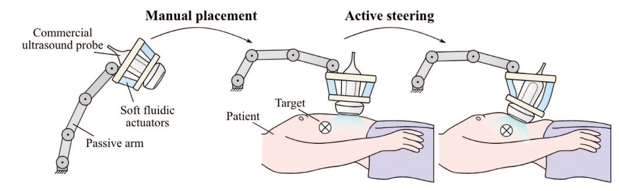Ultrasound robot using soft robotics