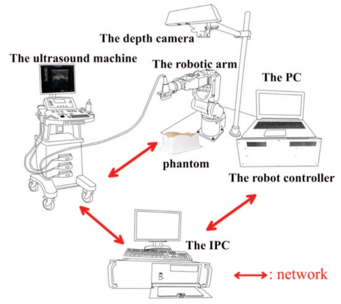Automated 3D ultrasound system