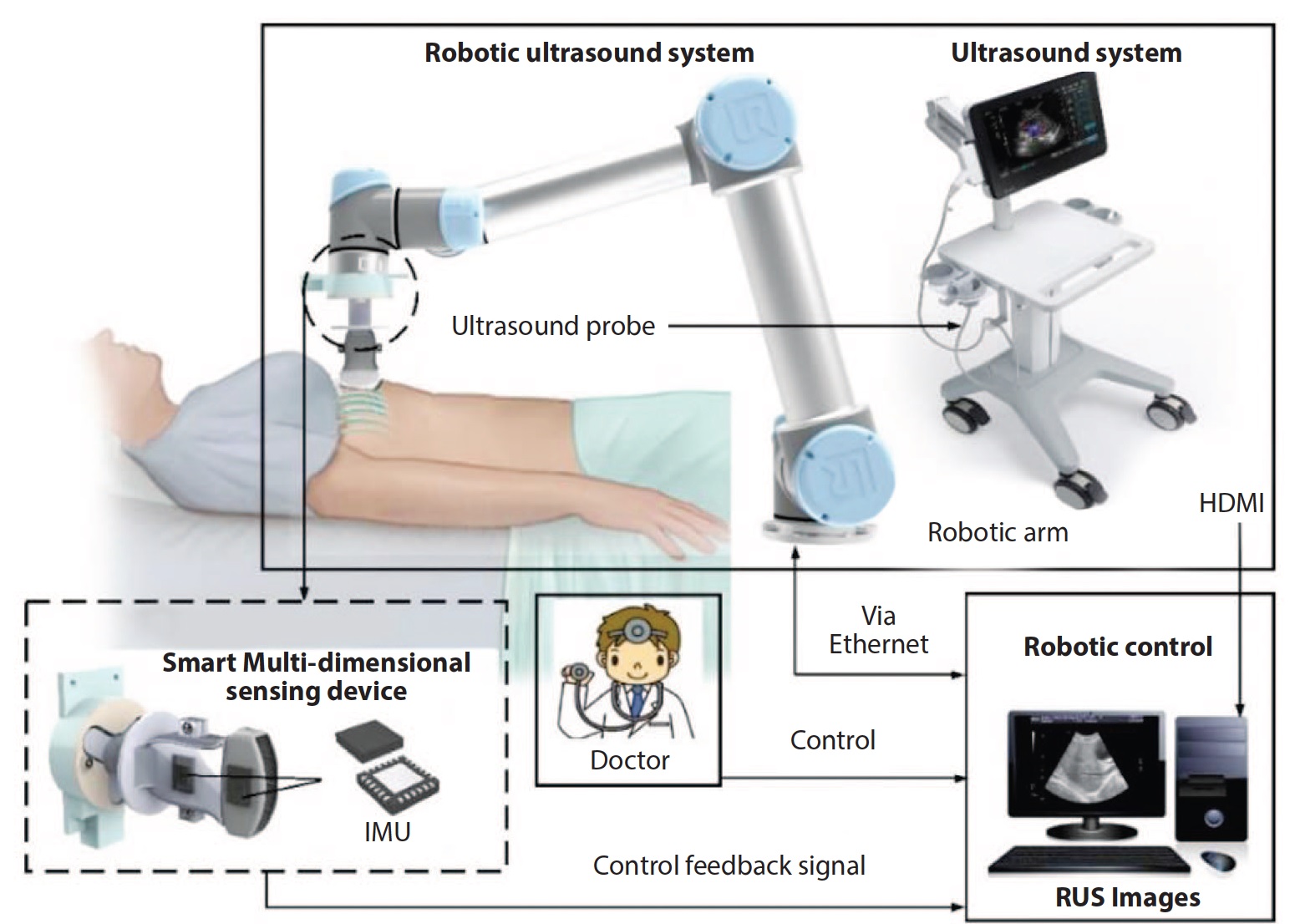 Ultrasonic system with gyrostabilizer