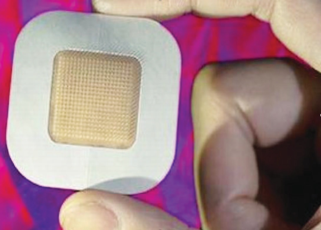 Smart patch size scale