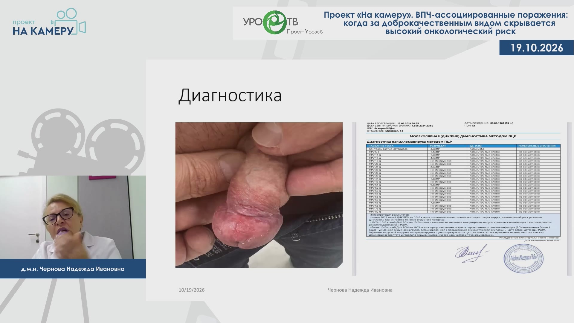Чернова Н.И., Дроздова А.В. — ВПЧ-ассоциированные поражения: когда за доброкачественным видом скрывается высокий онкологический риск