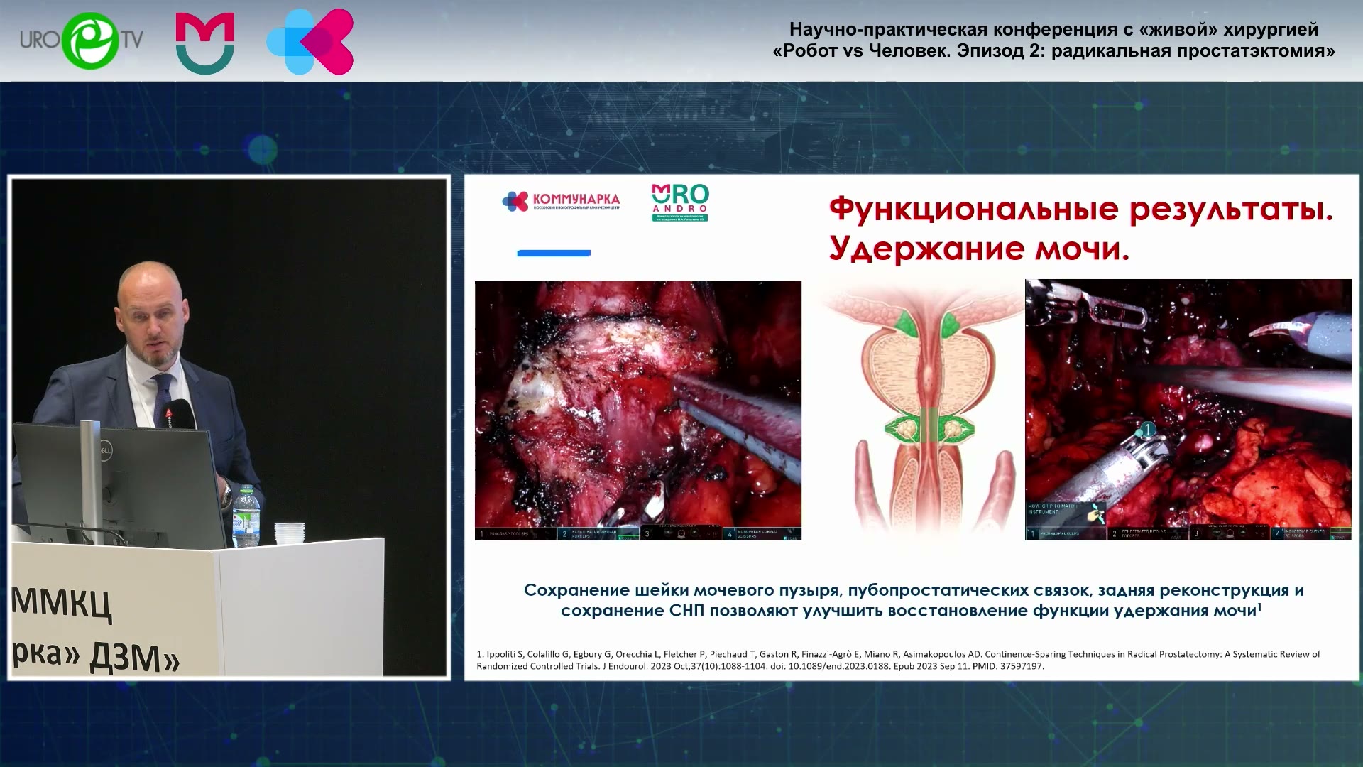 Онкологические и функциональные результаты радикальной простатэктомии в ММКЦ Коммунарка